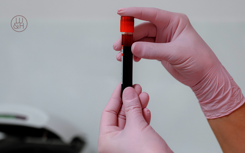 HPV-Cotestung: Wissen, das schützt