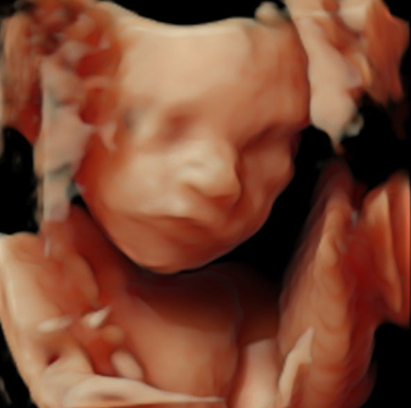 3D Ultraschall in der Schwanger­schafts­woche